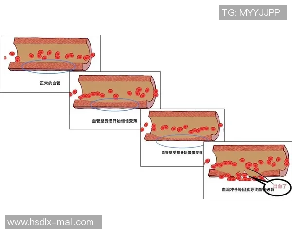 踢足球时意外受伤出血的原因与预防措施探讨 踢足球时意外受伤出血的原因与预防措施探讨